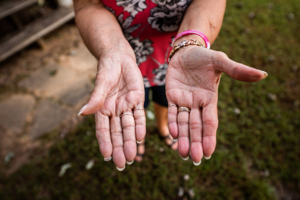 A photo of a woman showing her hands.